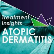 Podcast Atopic Dermatitis Treatment Insights