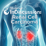 Podcast Medscape InDiscussion: Renal Cell Carcinoma